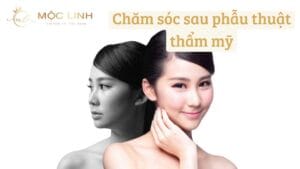 Chăm sóc sau phẫu thuật thẩm mỹ tại Thẩm Mỹ Mộc Linh Hải Phòng - hình 3