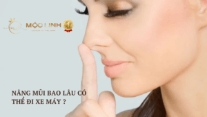 Nâng mũi bao lâu có thể đi xe máy ? tại Thẩm Mỹ Mộc Linh Hải Phòng - hình 4