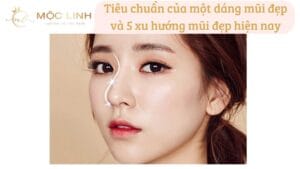Tiêu chuẩn của một dáng mũi đẹp và 5 xu hướng mũi đẹp tại Thẩm Mỹ Mộc Linh Hải Phòng - hình 3