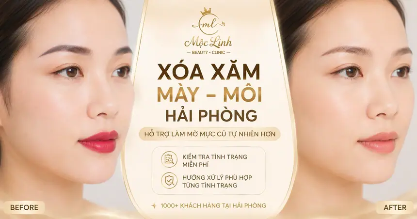 Xóa Mày - Môi