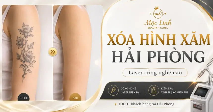 Xóa Hình Xăm