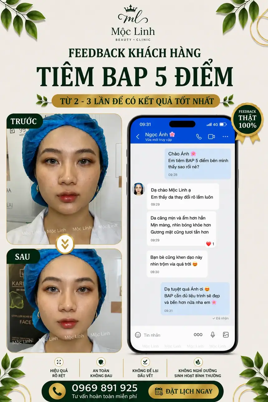 Tiêm BAP tại Thẩm Mỹ Mộc Linh Hải Phòng - hình 5