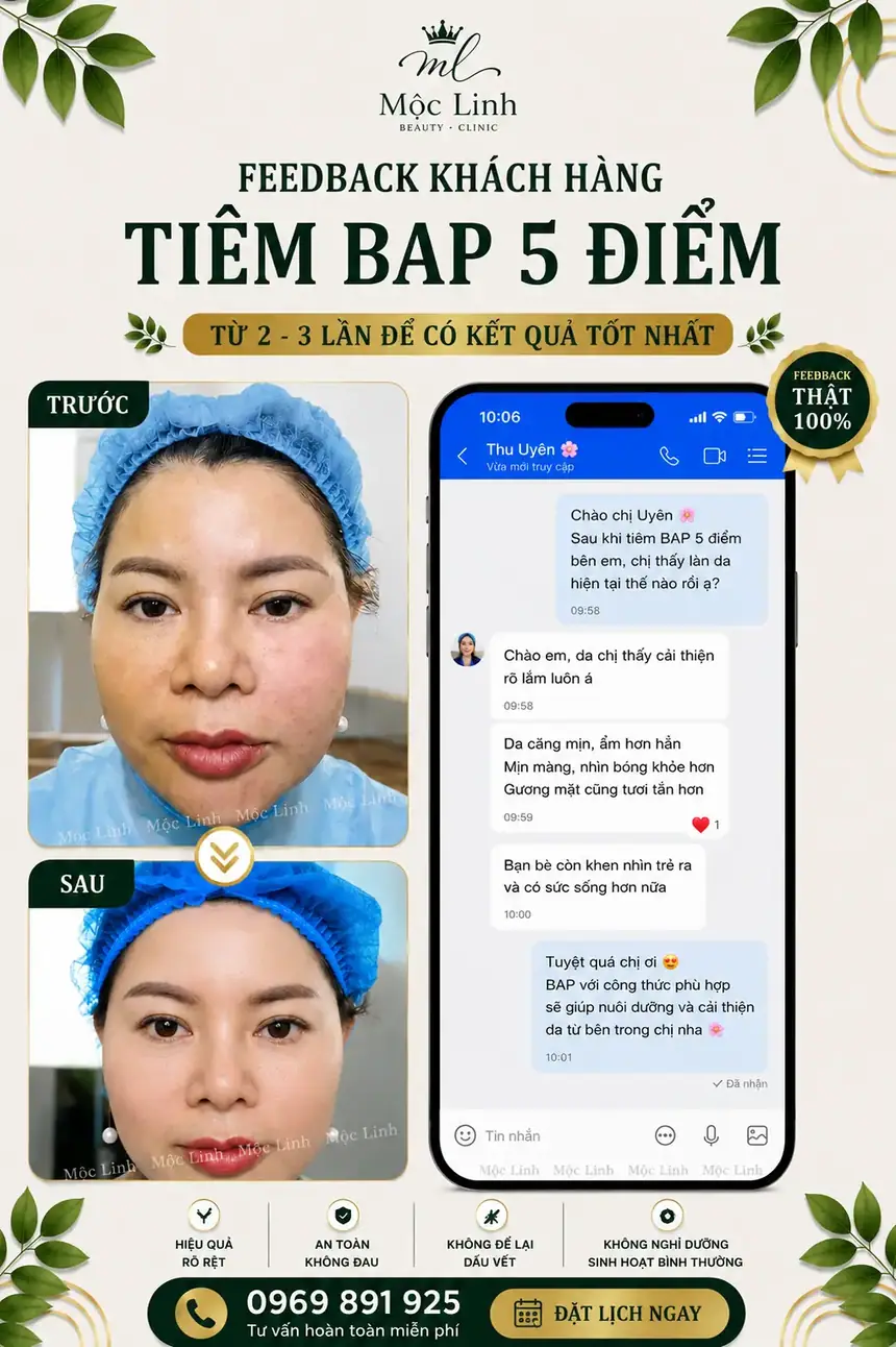 Tiêm BAP tại Thẩm Mỹ Mộc Linh Hải Phòng - hình 6