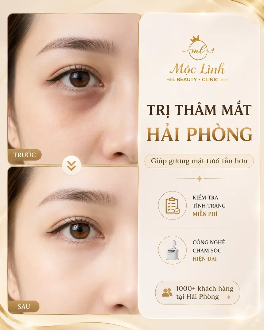 Chữa thâm mắt uy tín Hải Phòng tại Thẩm Mỹ Mộc Linh - hình 1