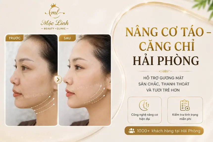 Nâng cơ táo (Căng chỉ) uy tín tại Hải Phòng tại Thẩm Mỹ Mộc Linh - hình 1