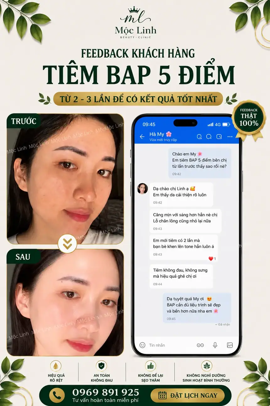 Tiêm BAP tại Thẩm Mỹ Mộc Linh Hải Phòng - hình 7