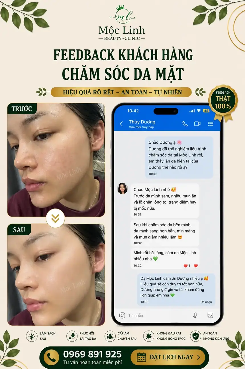Chăm sóc da mặt tại Thẩm Mỹ Mộc Linh Hải Phòng - hình 7