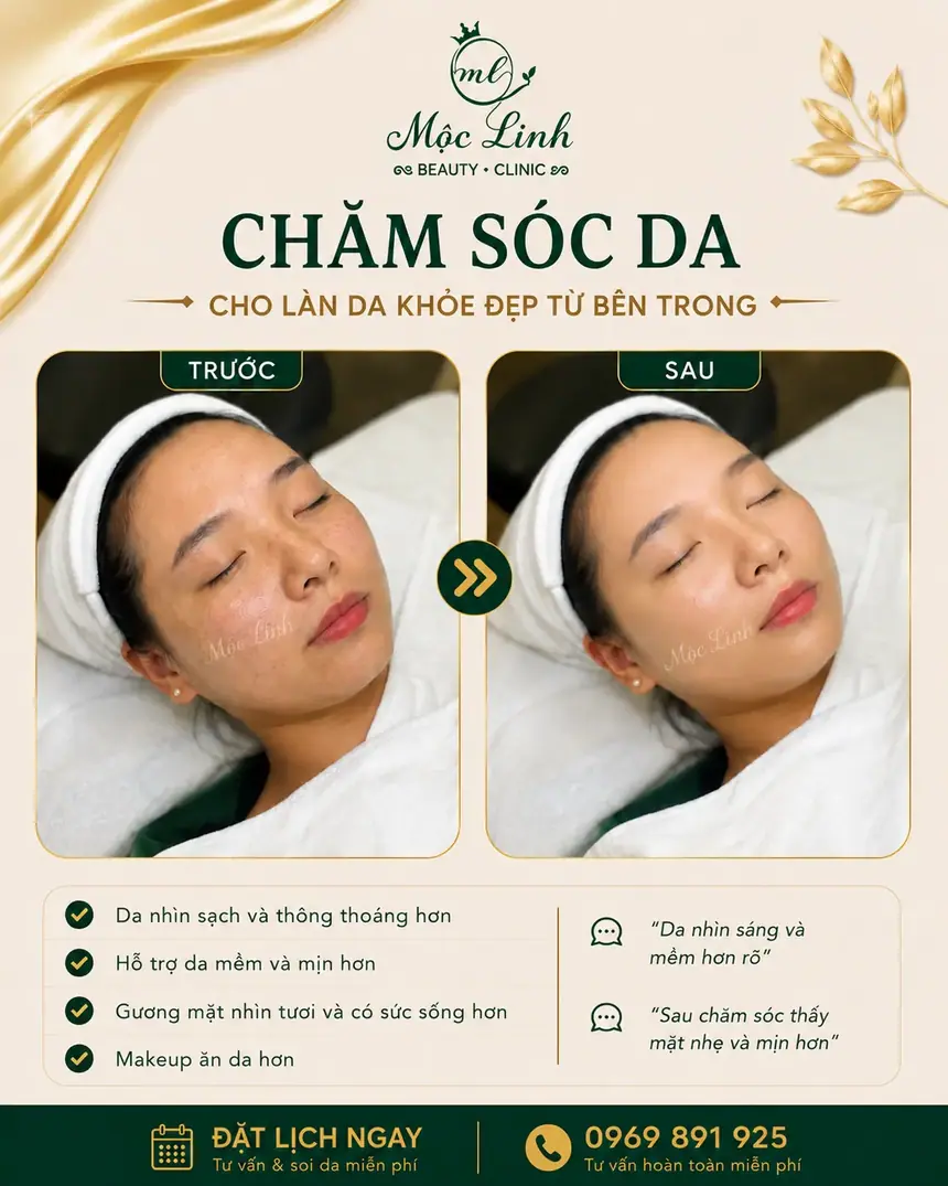 Chăm sóc da mặt tại Thẩm Mỹ Mộc Linh Hải Phòng - hình 4