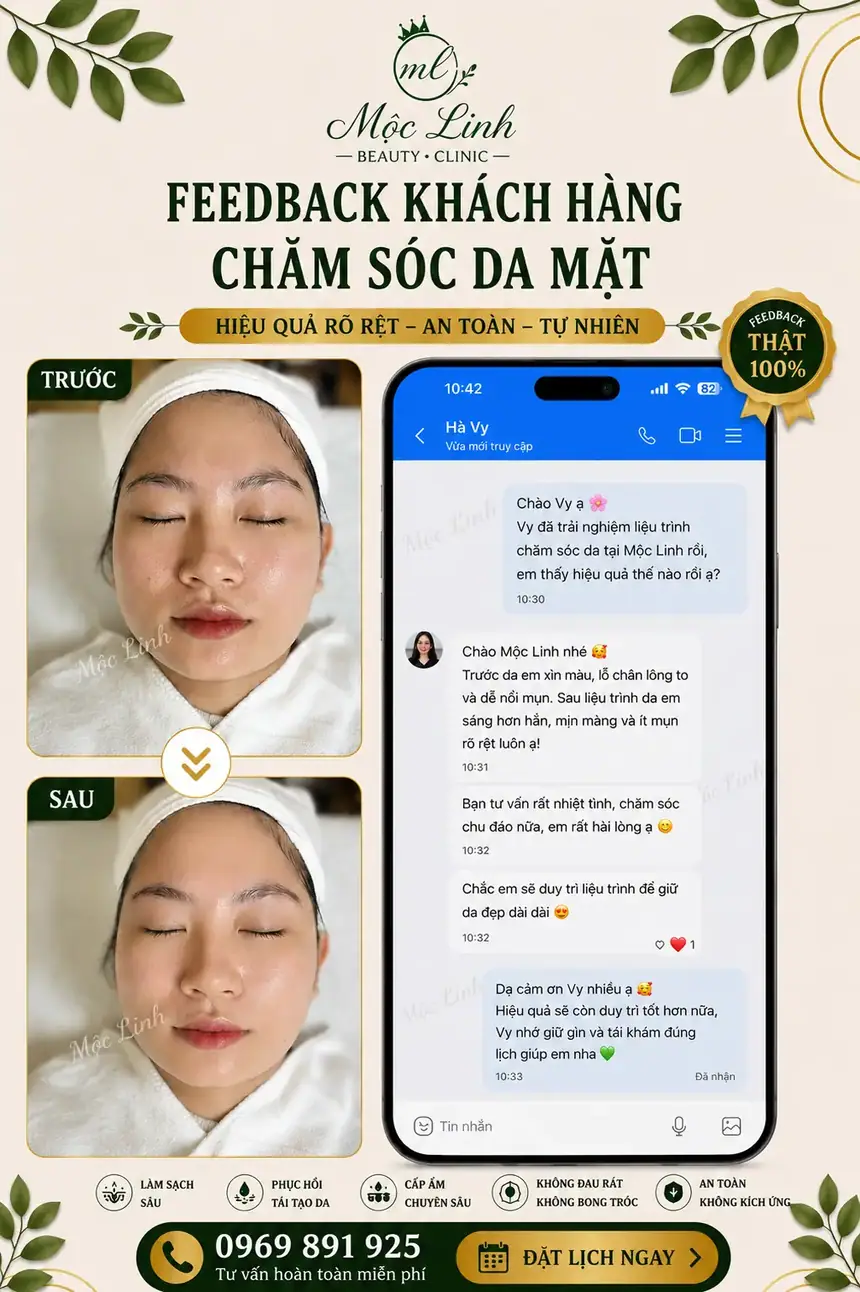 Chăm sóc da mặt tại Thẩm Mỹ Mộc Linh Hải Phòng - hình 6