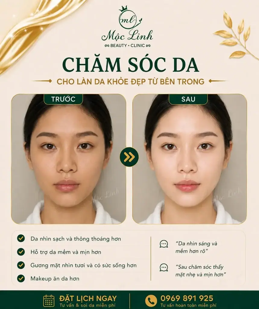 Chăm sóc da mặt tại Thẩm Mỹ Mộc Linh Hải Phòng - hình 6