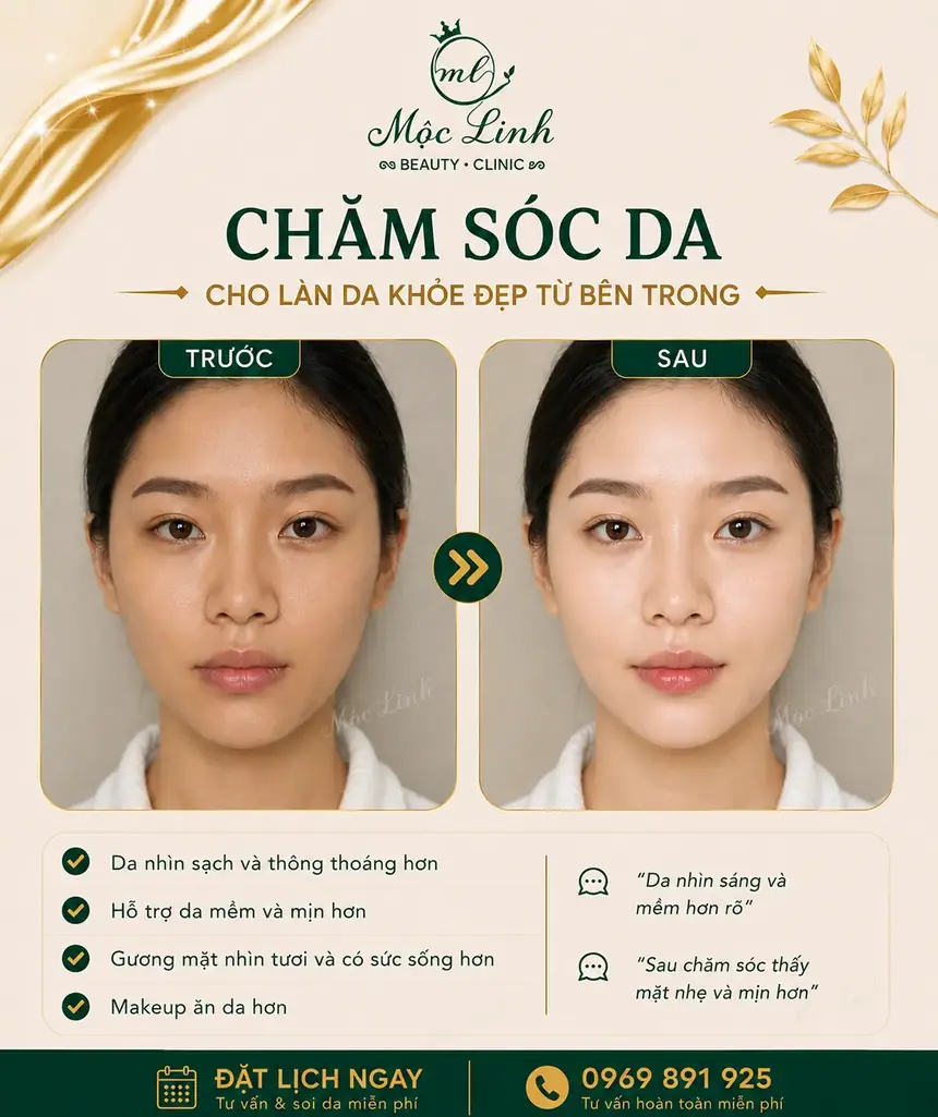 Chăm sóc da mặt tại Thẩm Mỹ Mộc Linh Hải Phòng - hình 5