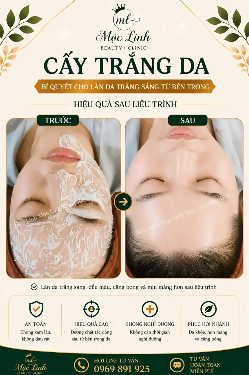 Cấy trắng da tại Thẩm Mỹ Mộc Linh Hải Phòng - hình 4