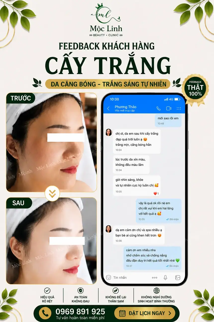 Cấy trắng da tại Thẩm Mỹ Mộc Linh Hải Phòng - hình 6