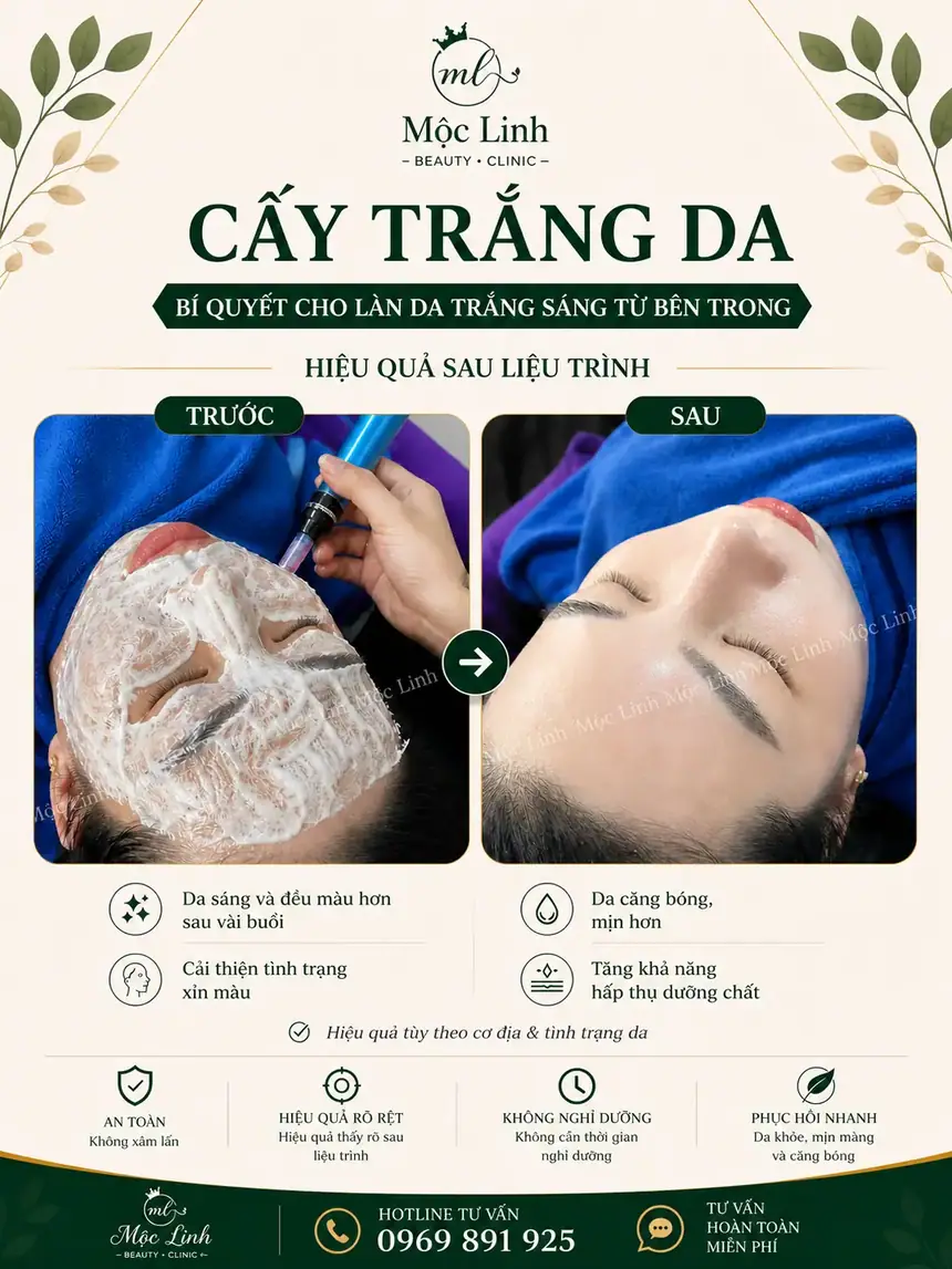 Cấy trắng da tại Thẩm Mỹ Mộc Linh Hải Phòng - hình 5