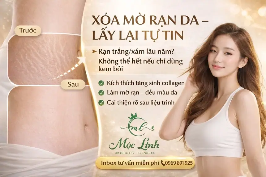 Chữa rạn da tại Thẩm Mỹ Mộc Linh Hải Phòng - hình 3