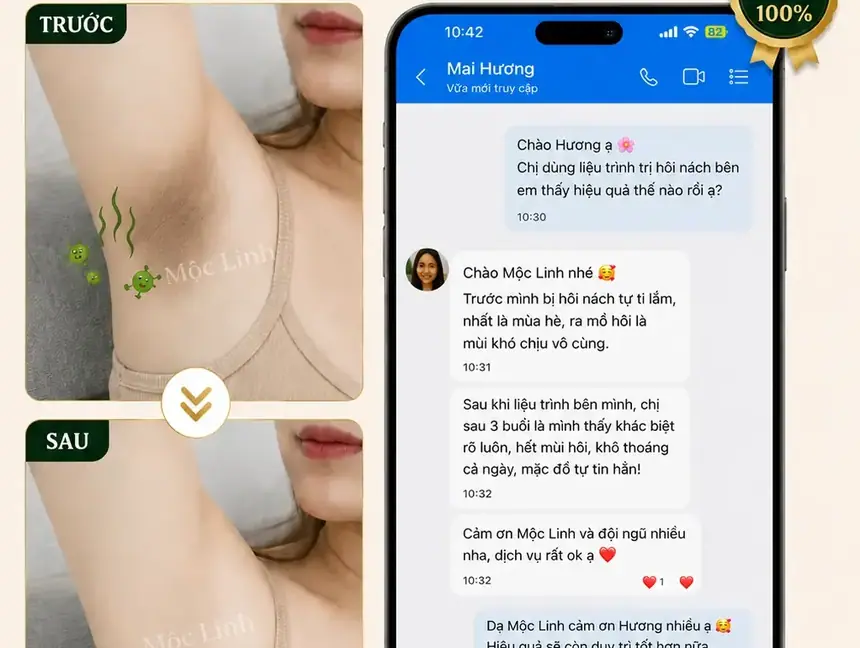 Trị hôi nách Hải Phòng tại Thẩm Mỹ Mộc Linh - hình 1