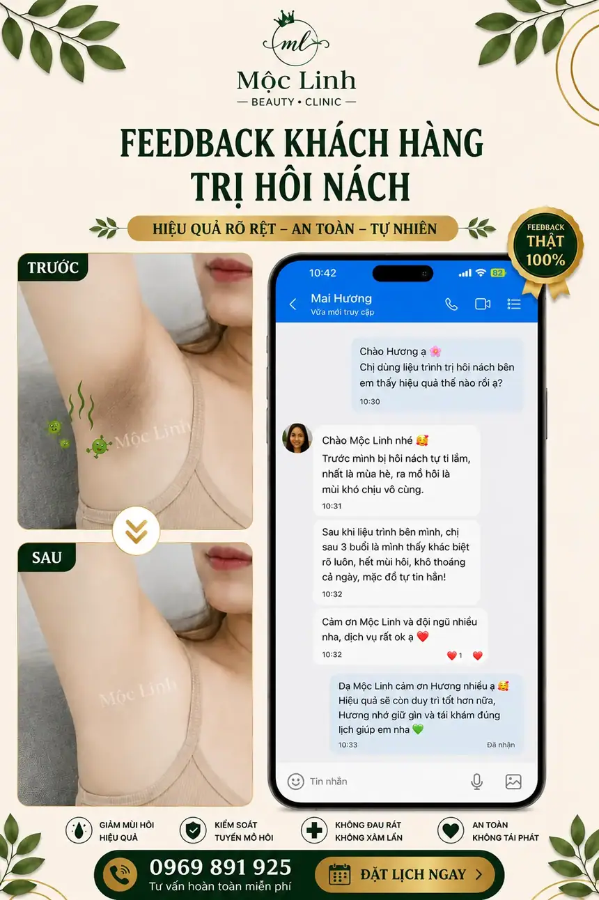 Trị hôi nách Hải Phòng tại Thẩm Mỹ Mộc Linh - hình 6