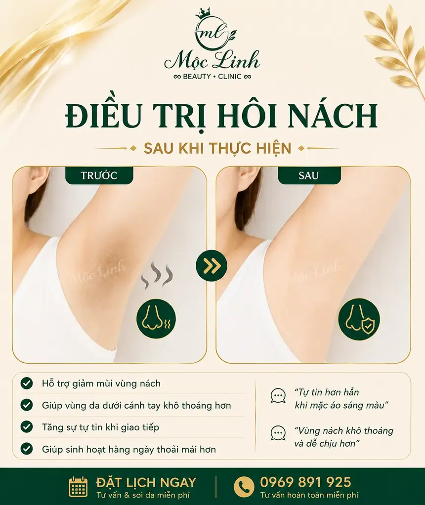 Trị hôi nách Hải Phòng tại Thẩm Mỹ Mộc Linh - hình 4