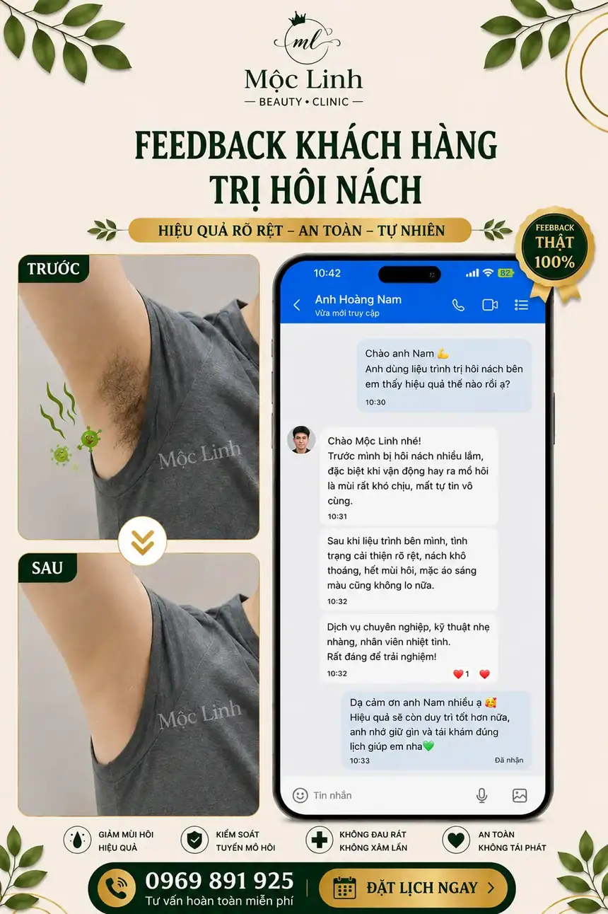 Trị hôi nách Hải Phòng tại Thẩm Mỹ Mộc Linh - hình 5