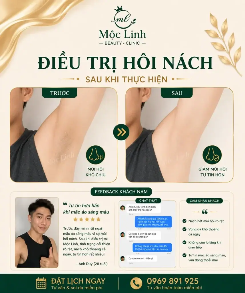 Trị hôi nách Hải Phòng tại Thẩm Mỹ Mộc Linh - hình 9