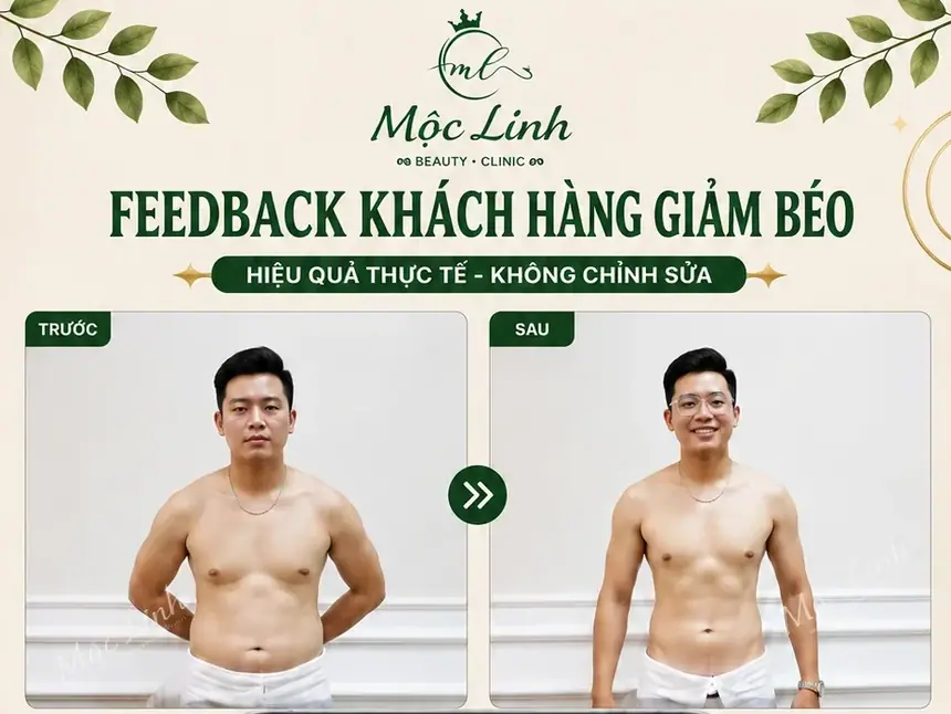Giảm Béo An Toàn Hải Phòng tại Thẩm Mỹ Mộc Linh - hình 2