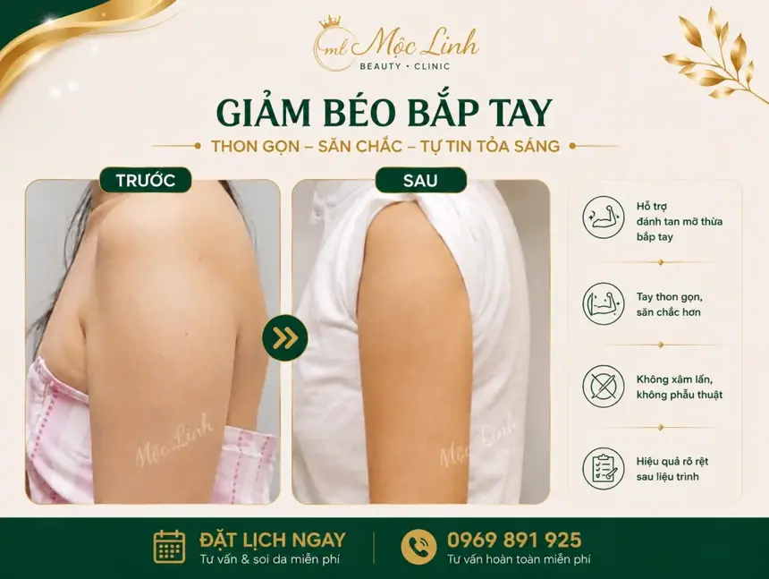 Giảm Béo An Toàn Hải Phòng tại Thẩm Mỹ Mộc Linh - hình 10