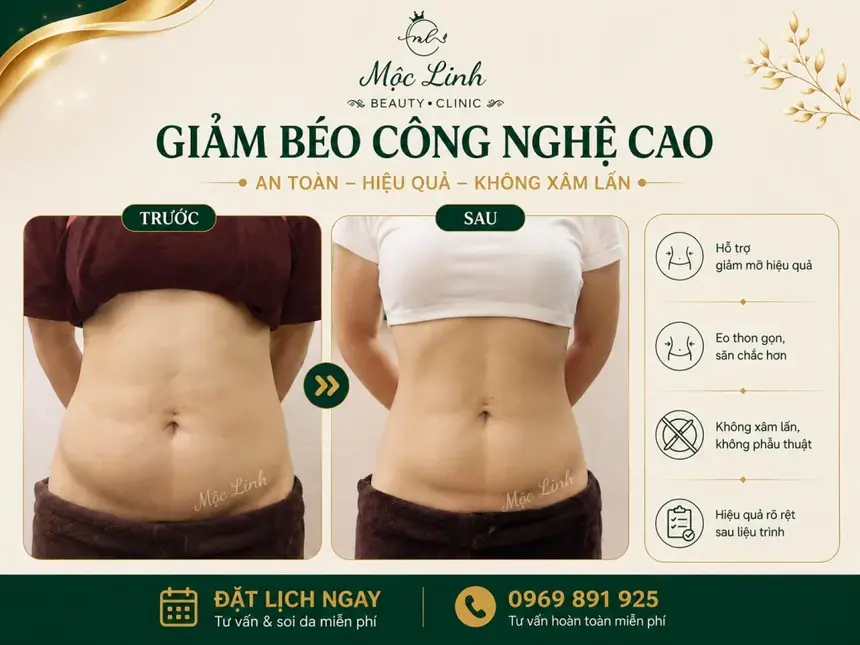 Giảm Béo An Toàn Hải Phòng tại Thẩm Mỹ Mộc Linh - hình 9