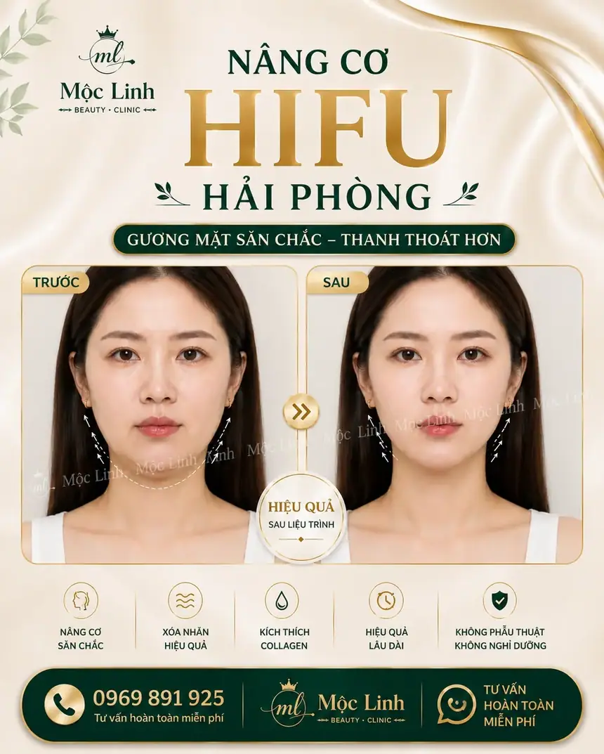 Nâng cơ công nghệ Hifu hiện đại bậc nhất tại Thẩm Mỹ Mộc Linh Hải Phòng - hình 1