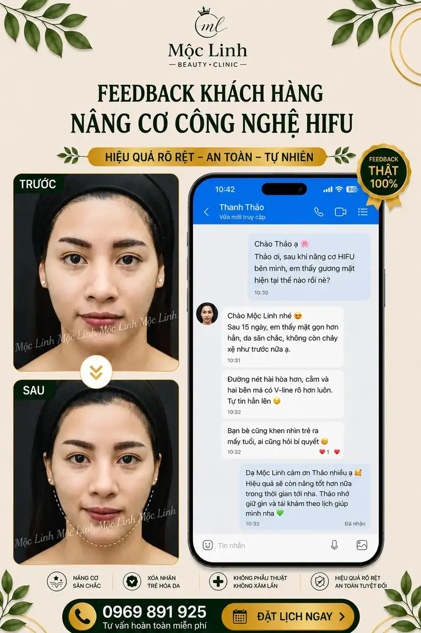 Nâng cơ công nghệ Hifu hiện đại bậc nhất tại Thẩm Mỹ Mộc Linh Hải Phòng - hình 7