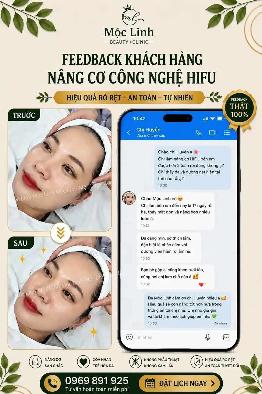 Nâng cơ công nghệ Hifu hiện đại bậc nhất tại Thẩm Mỹ Mộc Linh Hải Phòng - hình 5