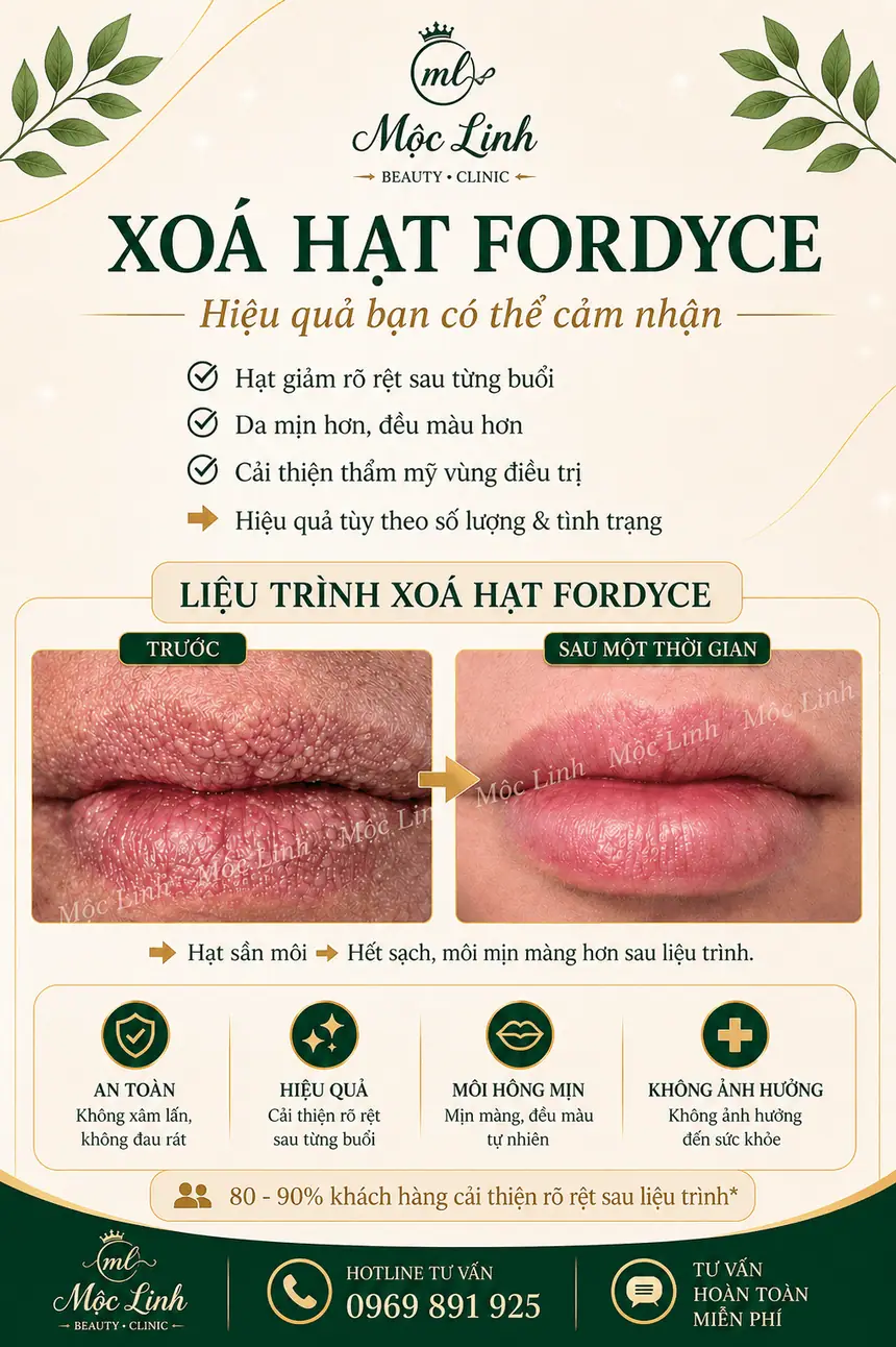 Xoá hạt Fordyce Hải Phòng tại Thẩm Mỹ Mộc Linh - hình 4