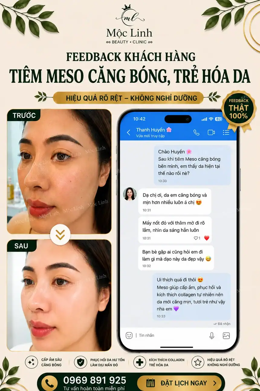 Công nghệ tiêm meso hiện đại tại Hải Phòng
