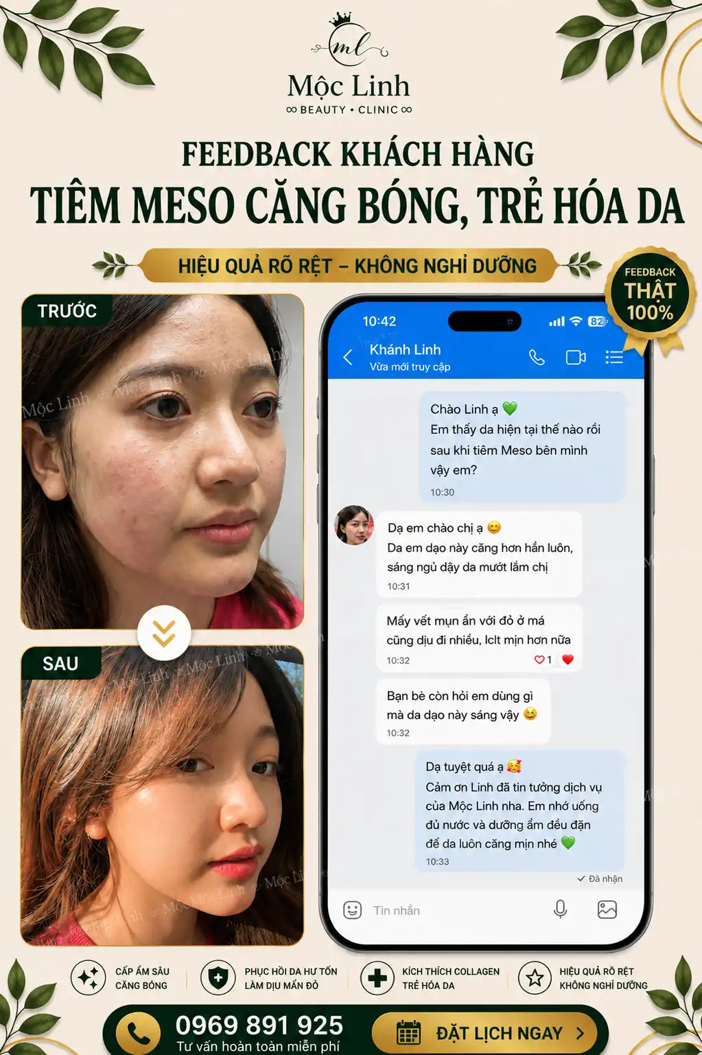 Tiêm meso phục hồi da hư tổn tại Thẩm Mỹ Mộc Linh
