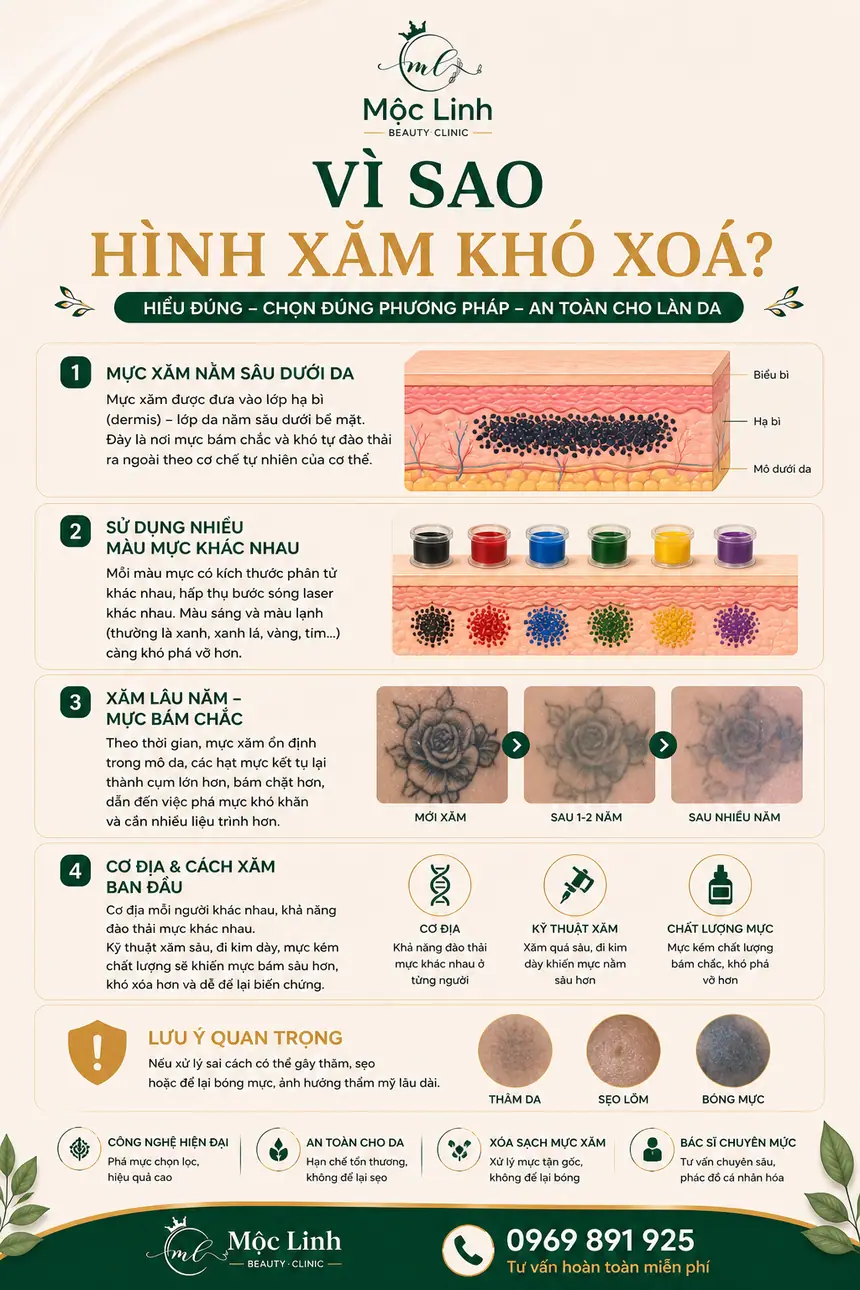 Xoá hình xăm Hải Phòng tại Thẩm Mỹ Mộc Linh - hình 2