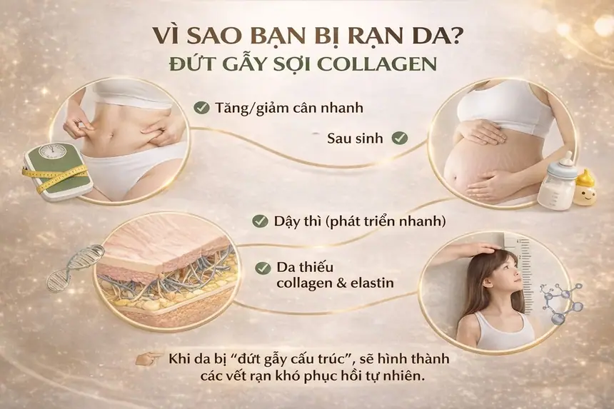 Chữa rạn da tại Thẩm Mỹ Mộc Linh Hải Phòng - hình 8