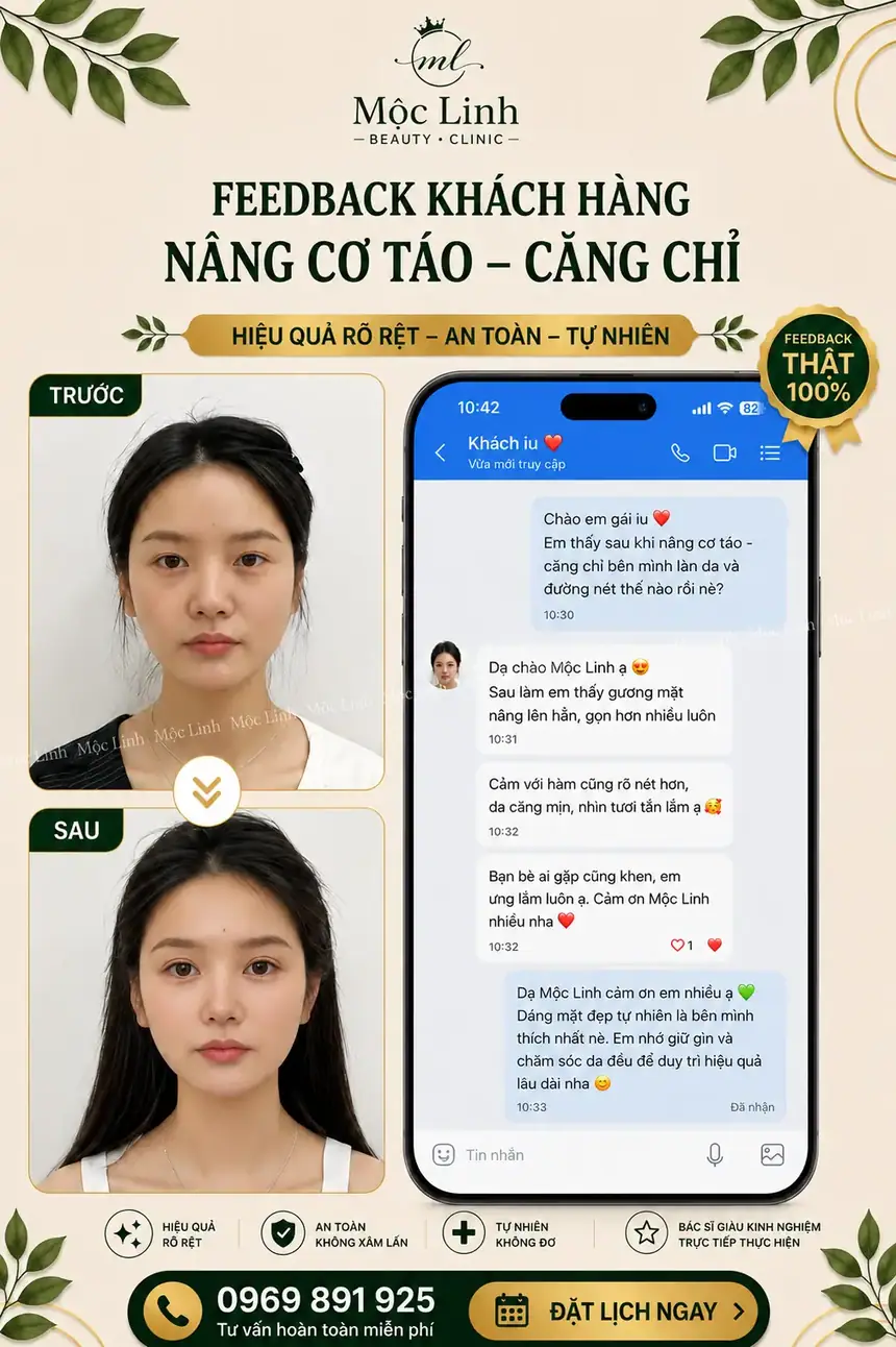 Nâng cơ táo (Căng chỉ) uy tín tại Hải Phòng tại Thẩm Mỹ Mộc Linh - hình 5