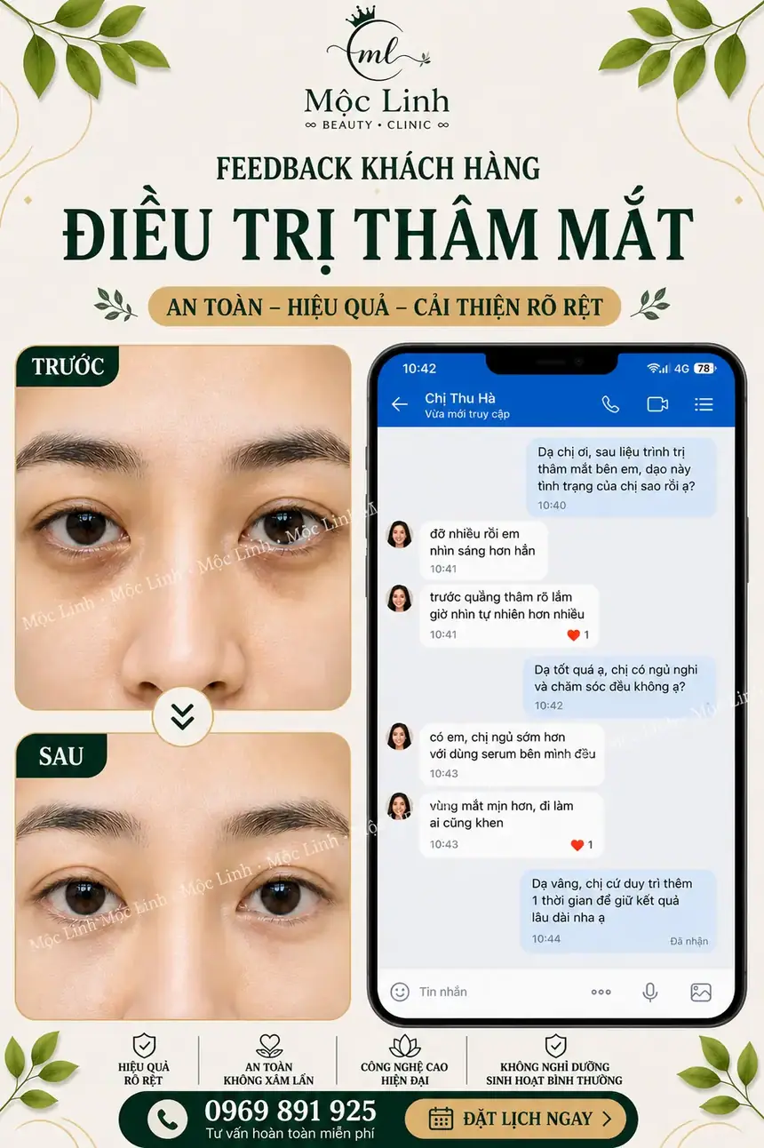 Chữa thâm mắt uy tín Hải Phòng tại Thẩm Mỹ Mộc Linh - hình 8