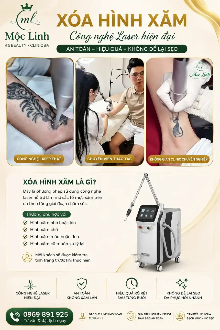 Xoá hình xăm Hải Phòng tại Thẩm Mỹ Mộc Linh - hình 3