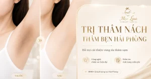 Trị thâm nách - bẹn Hải Phòng tại Thẩm Mỹ Mộc Linh - hình 9