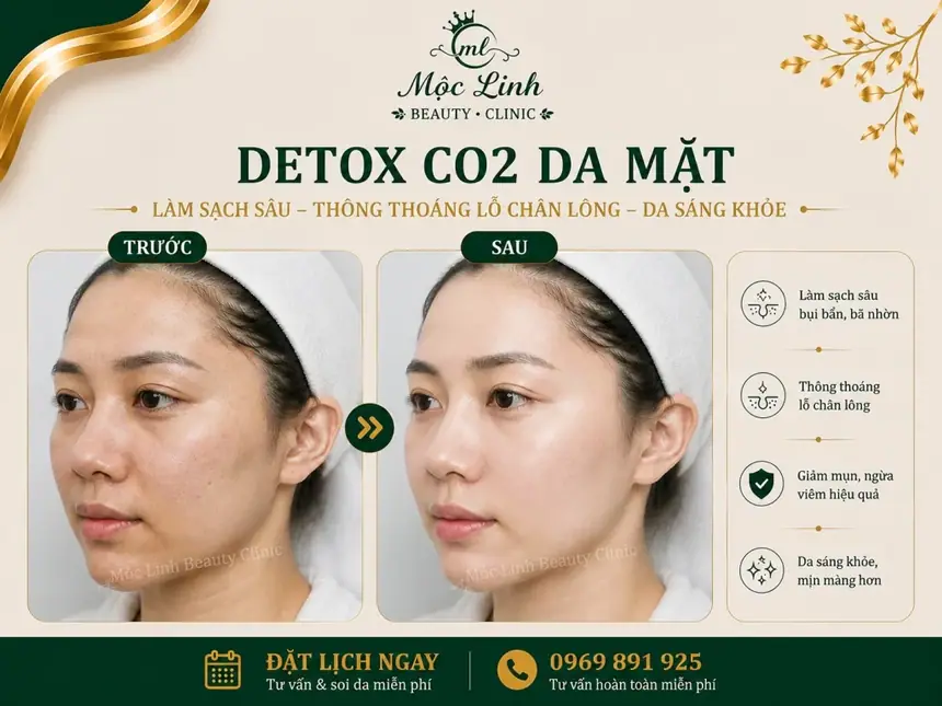 Detox CO2 Hải Phòng – Khi Làn Da Cần Được Làm Sạch Và tại Thẩm Mỹ Mộc Linh - hình 8