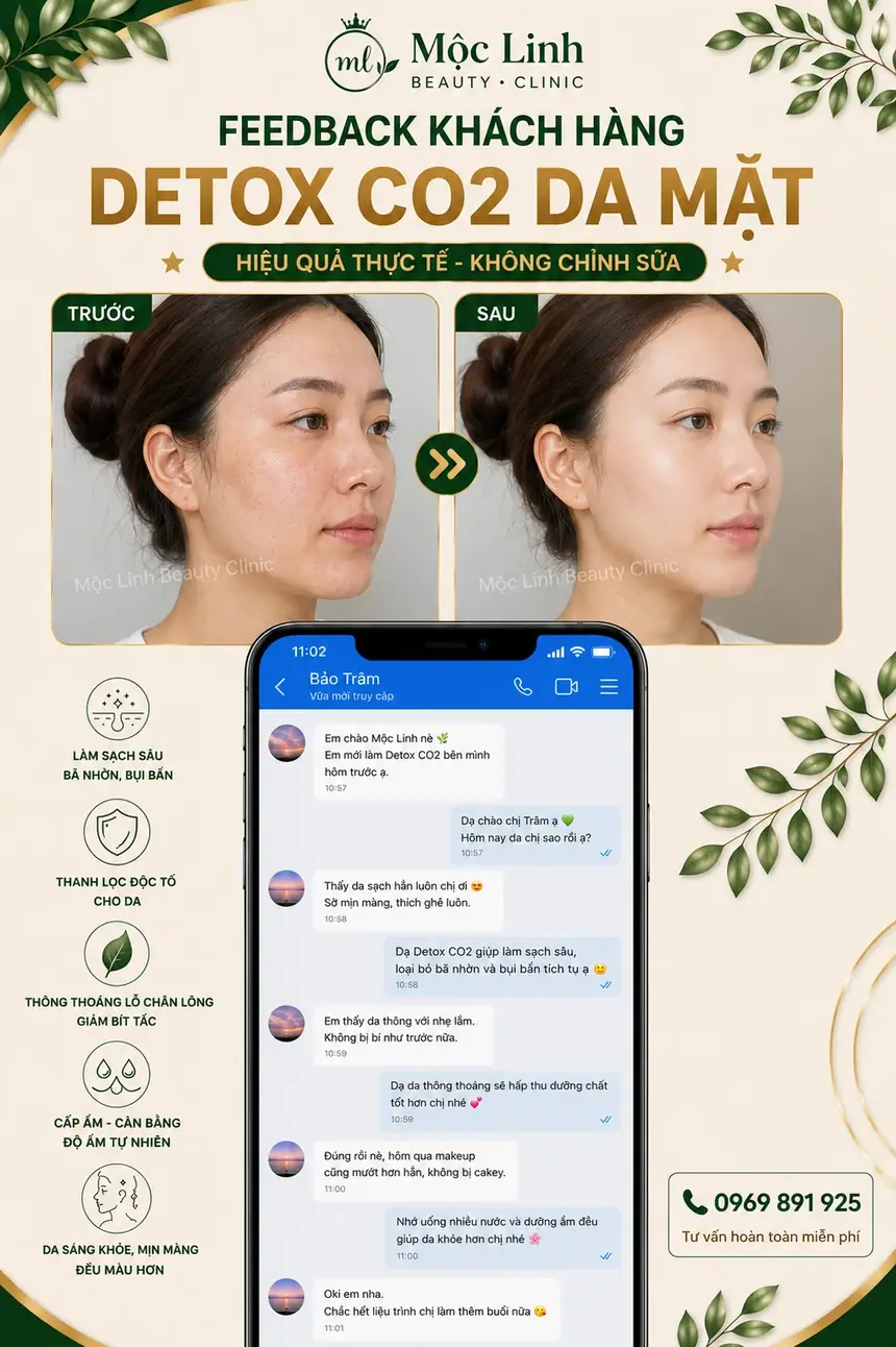 Detox da CO2 công nghệ cao tại Mộc Linh Hải Phòng