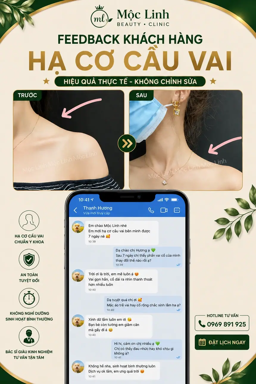 Tiêm Hạ Cơ Cầu Vai Hải Phòng tại Thẩm Mỹ Mộc Linh - hình 5