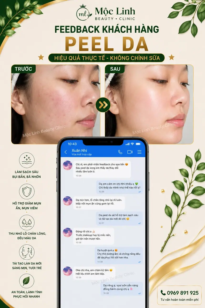 Dịch vụ peel da uy tín tại Hải Phòng