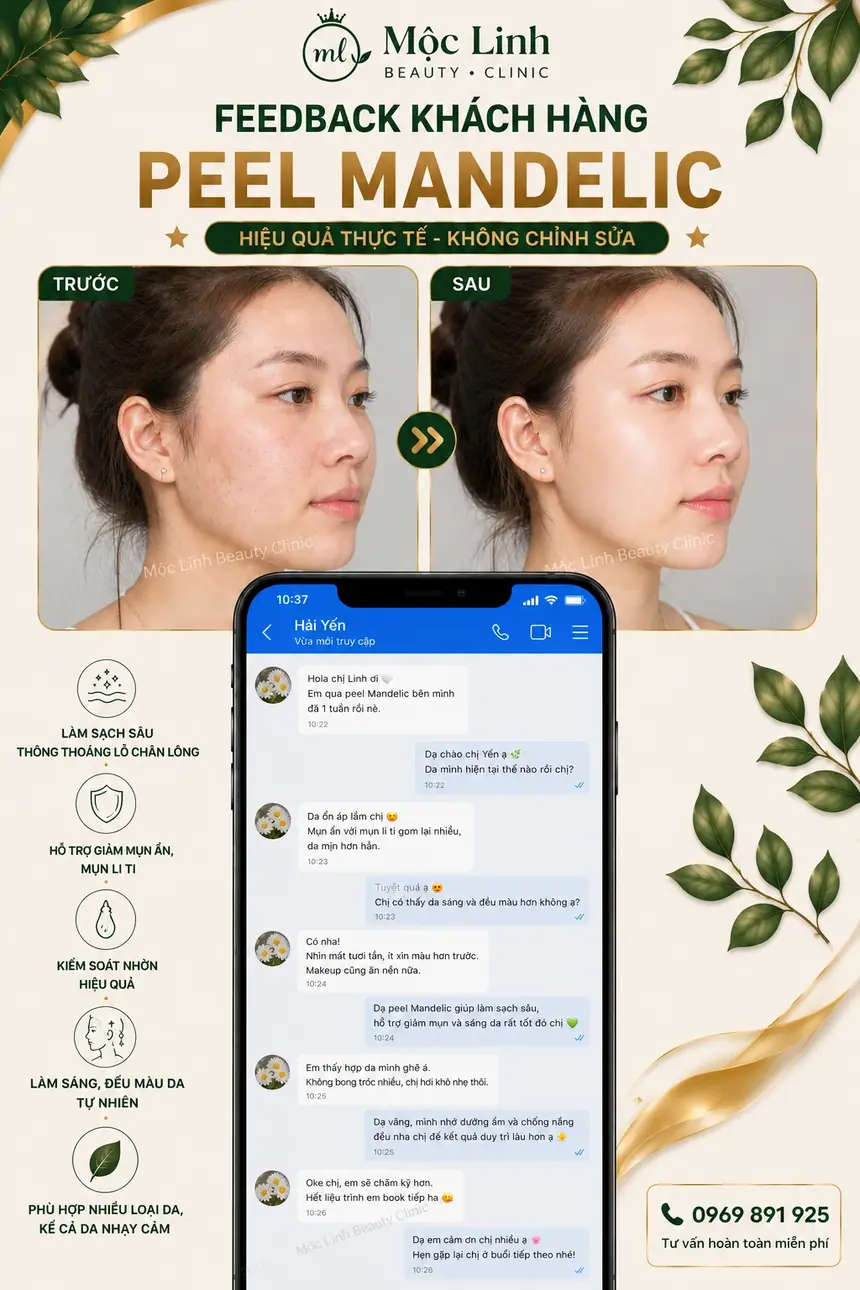 Chăm sóc da với peel da tại Hải Phòng