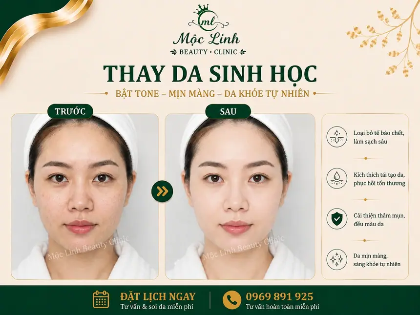 Hình ảnh thực tế dịch vụ thay da sinh học tại Hải Phòng