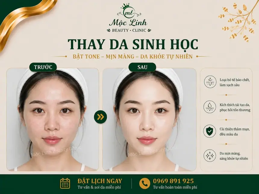 Thay Da Sinh Học Hải Phòng – Khi Làn Da Cần Một Chu Kỳ tại Thẩm Mỹ Mộc Linh - hình 4