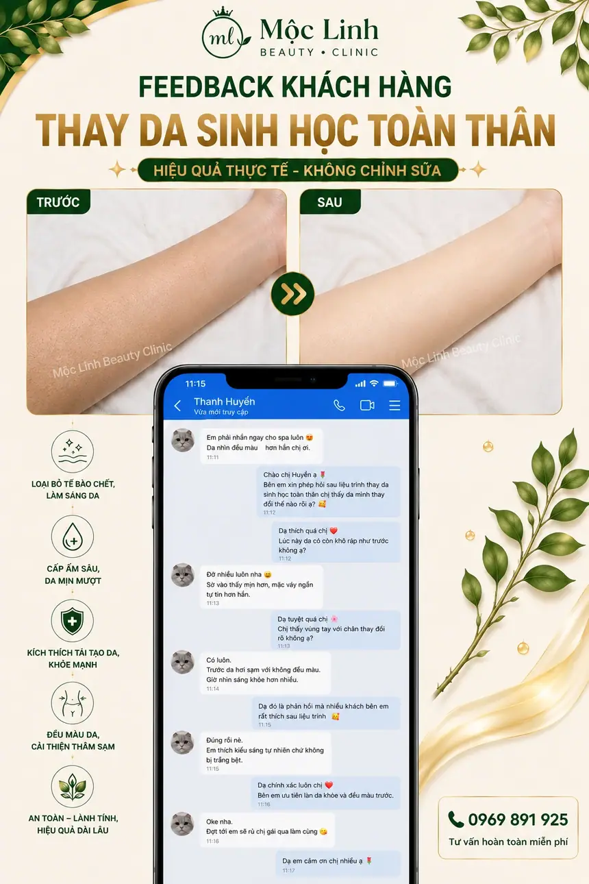 Chăm sóc da với thay da sinh học tại Hải Phòng