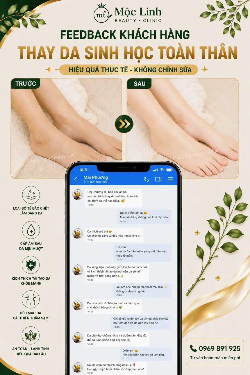 Thay da sinh học công nghệ cao tại Mộc Linh Hải Phòng