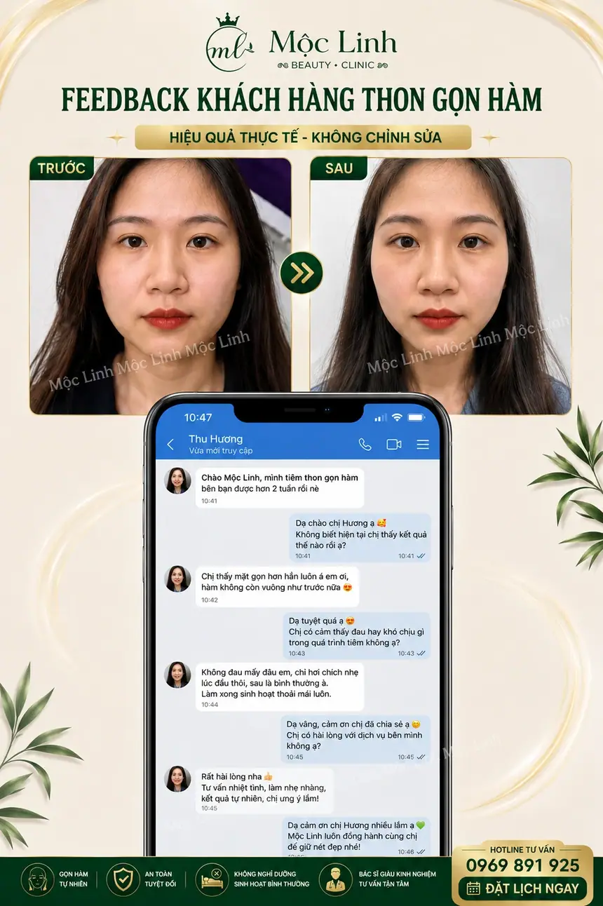 Tiêm Thon Gọn Hàm Hải Phòng tại Thẩm Mỹ Mộc Linh - hình 6