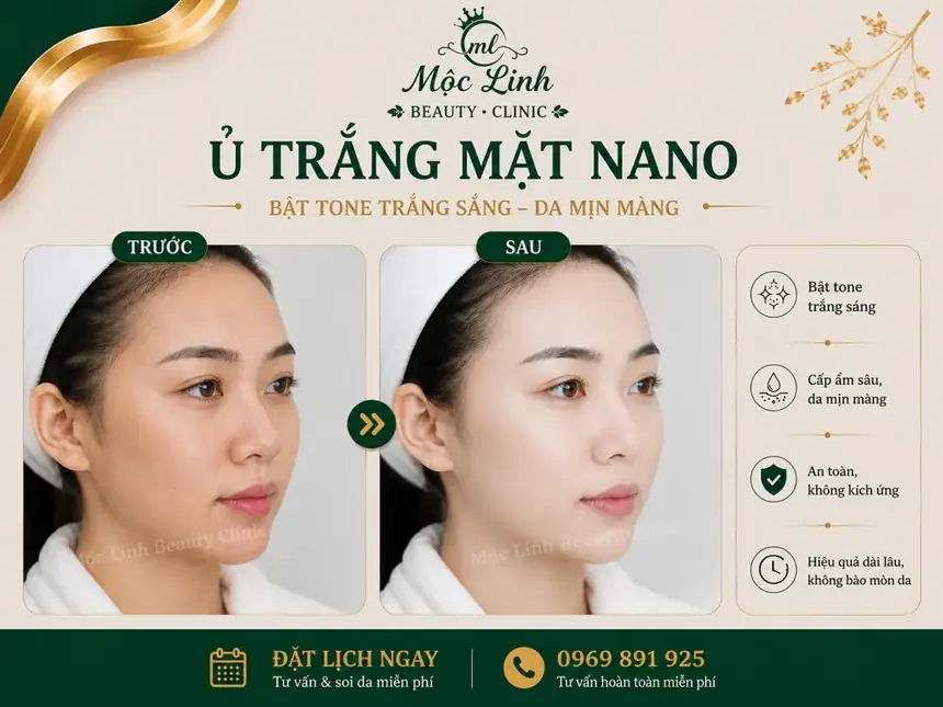 Ủ Trắng Mặt Nano Hải Phòng – Khi Làn Da Xỉn Màu Cần tại Thẩm Mỹ Mộc Linh - hình 6